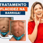 Como tratar Flacidez na Barriga ?